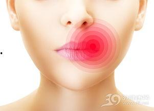 吃瓜烂嘴角怎么办视频,实用小妙招大揭秘